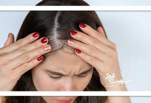 چطور ریزش مو را کنترل کنیم؟