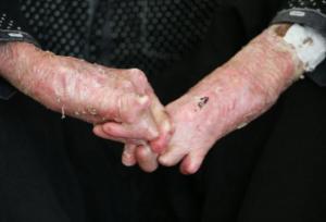 ضرورت اطلاع‌رسانی درباره ازدواج‌های فامیلی و بیماری‌های ژنتیکی