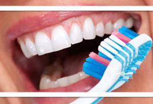 جرم گیری طبیعی دندان با مواد غذایی دم دستی