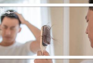 ارتباط داروی رایج ضد ریزش مو با ریسک افسردگی و خودکشی