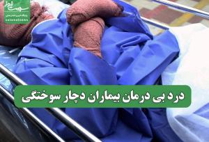 درد بی درمان بیماران دچار سوختگی