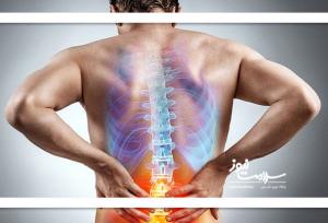دیسک کمر با این علائم خود را نشان می‌دهد