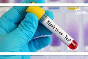 ویروس نیپا چیست و چقدر باید نگران آن باشیم؟