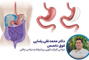نظر دکتر محمدتقی رضایی متخصص جراحی چاقی در مورد اسلیو معده