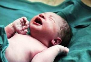 نوزاد ۷۷۰ گرمی در بیمارستان علوی اردبیل متولد شد