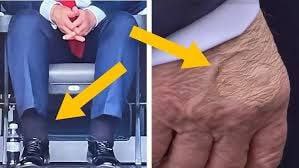 بیماری ترامپ خبرساز شد