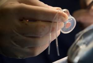 آغاز عملیات صید حلزون‌های ناقل شیستوزومیازیس در غرب اهواز