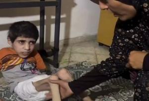 تراژدی غم‌بار جنگ برای کودکان غزه/ پیامدهای مستقیم ناامنی غذایی