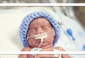 مبارزه برای زندگی: از مراقبت‌های حیاتی تا امید به آینده نوزادان نارس