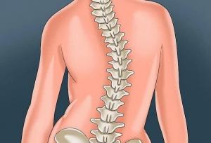 سه درصد مردم به انحراف ستون فقرات مبتلا هستند؛ تشخیص و درمان اسکولیوز