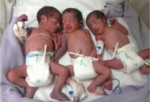 تولد سه قلوها در بیمارستان بعثت سنندج
