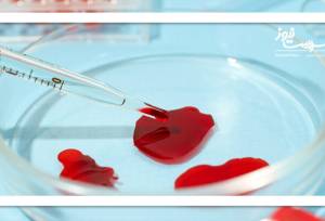 آزمایش خون قاعدگی؛ راهی ساده‌تر برای غربالگری سرطان دهانه رحم