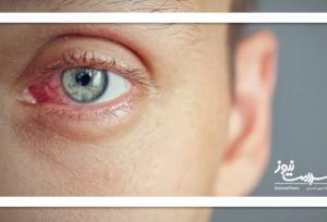 روش های کنترل خشکی چشم در زمستان