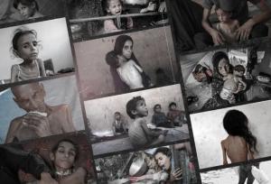 ادامه کابوس گرسنگی در غزه با پوشش آتش‌بس