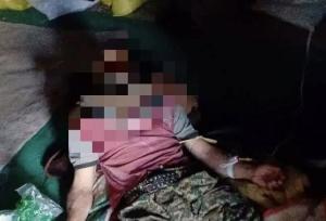 حمله خرس به نوجوان در سبزکوه بروجن
