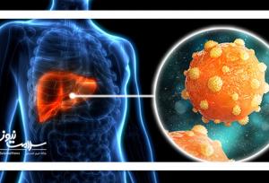هر آنچه لازم است در مورد هپاتیت بدانید