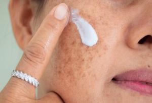با منافذ باز پوست چه کنیم؟
