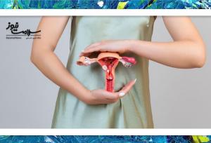 اندومتریوز؛ دردهای شدید دوران قاعدگی که نباید نادیده گرفته شود