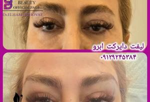 بهترین دکتر لیفت شقیقه در تهران + لیست ۱۰ دکتر برتر