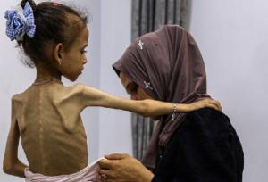 غرب و گرسنگی در غزه؛ وقتی شریک جرم دلسوز قربانی می‌شود!