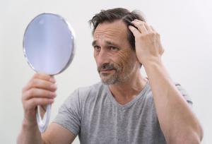 کاشت مو برای آقایان و بانوان؛ چه افرادی کاندید مناسب هستند؟