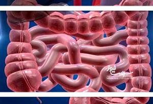 سلامت روده را با این نکات تضمین کنید