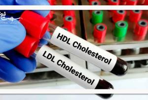 ارتباط LDL پایین با افزایش خطر دیابت نوع ۲