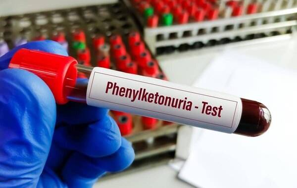  گسترش تولید و توزیع نان فاقد پروتئین برای بیماران