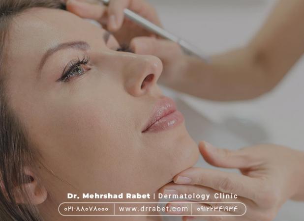 آیا خانم های باردار یا شیرده می توانند تزریق بوتاکس انجام دهند؟