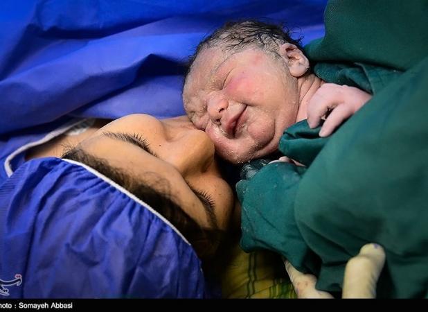 زایمان در بیمارستان خصوصی۳۰تا۸۵میلیون/اختلاف طبیعی و سزارین؟