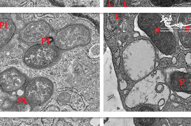 هوش مصنوعی راز تعادل سیستم ایمنی روده را فاش کرد: همکاری GIV و NOD2
