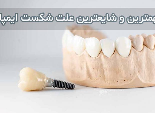 مهمترین و شایعترین علت شکست ایمپلنت