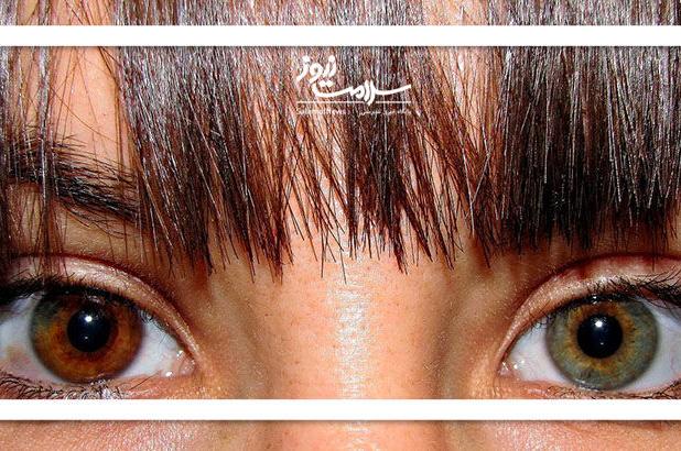 جراحی زیبایی خطرناکی که پشیمانی به بار می‌آورد