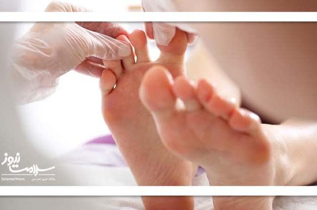 درمان زخم دیابتی با لیزر؛ امیدی نو برای بیماران دیابتی