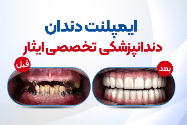 نتانیاهو گوش به زنگ دستورات ترامپ علیه ایران