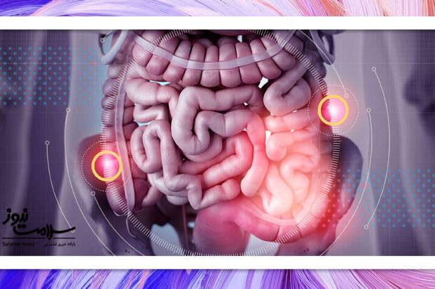 سرطان روده بزرگ عامل اصلی مرگ ناشی از سرطان در جوانان آمریکا شد
