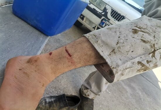 کاهش ۳ درصدی مراجعه مصدومین ناشی از گازگرفتگی سگ به پزشکی قانونی مازندران