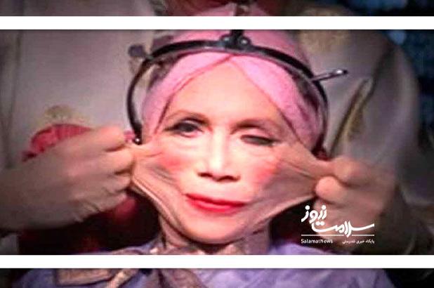 چالش‌های تبلیغات جراحی زیبایی در فضای مجازی: افزایش نظارت و آگاهی‌سازی ضروری است