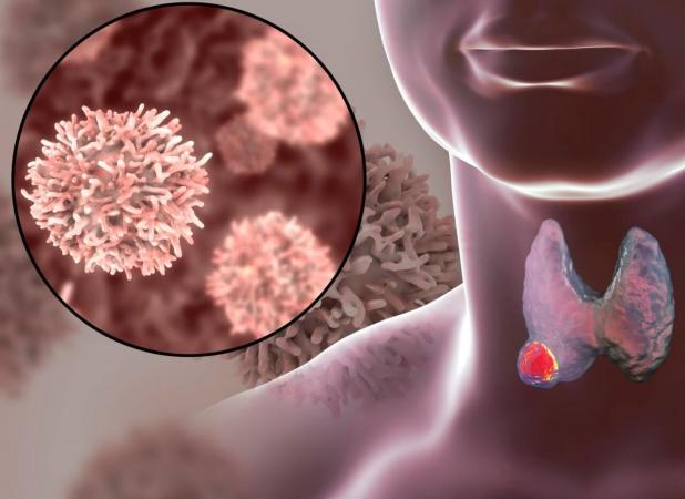 باکتری‌ دهان که سلول‌های سرطانی را نابود می‌کند
