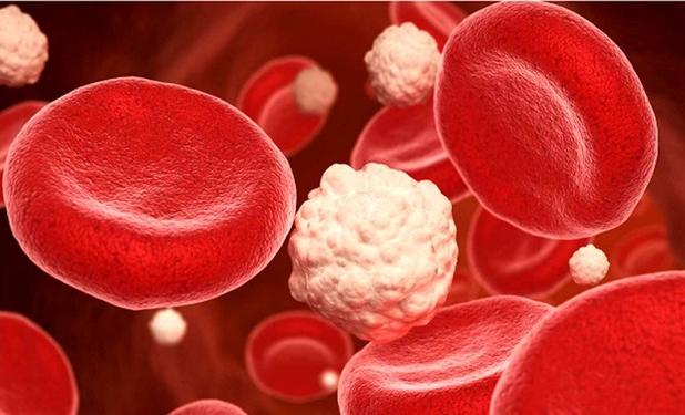 چگونه چربی خون بالا را کنترل کنیم؟