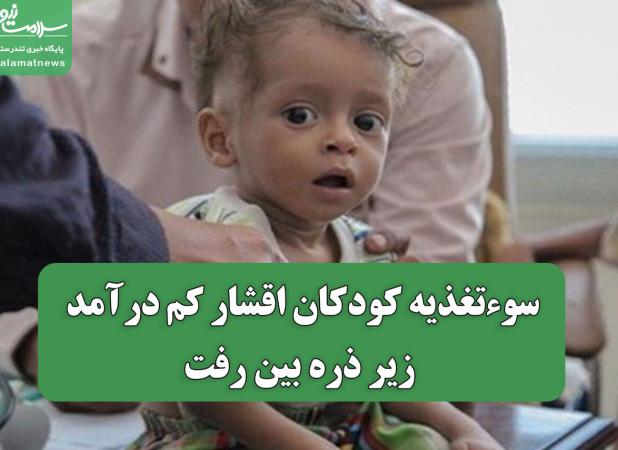 سوءتغذیه کودکان اقشار کم درآمد زیر ذره بین رفت