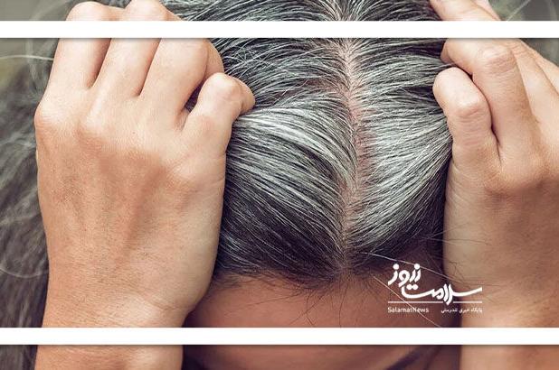آیا سفیدی مو همیشگی است؟