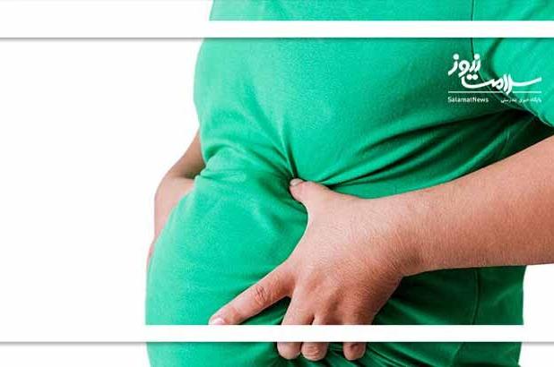 کدام افراد چاق نیاز به جراحی لاغری دارند؟