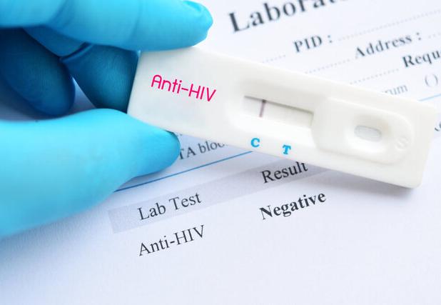 «انگ اجتماعی» چگونه مانع تست HIV می‌شود؟