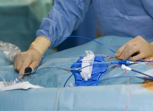 روش طلایی تشخیص تنگی عروق در بیماران قلب