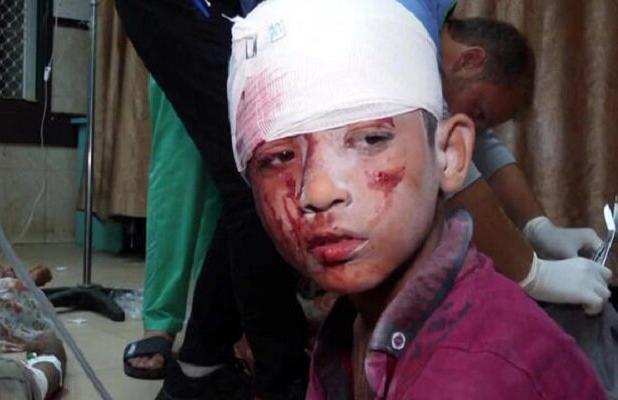 نتانیاهو به بهانه حادثه مجدل شمس مانع از درمان ۱۵۰ کودک غزه‌ای شد