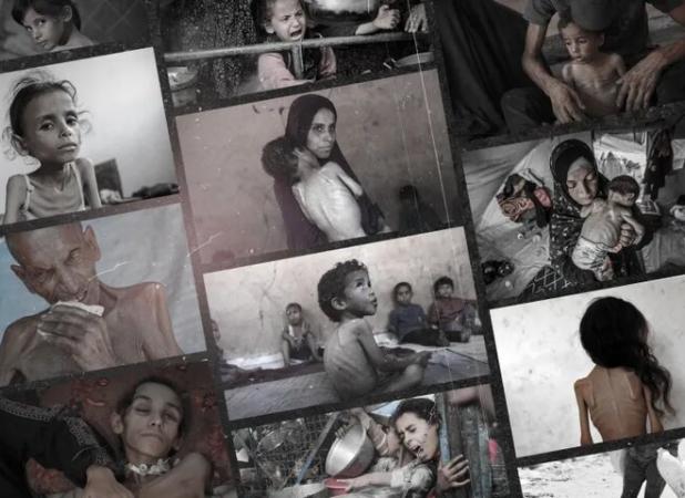 آمار شهدای قحطی در غزه طی ۲۴ ساعت ۲ رقمی شد
