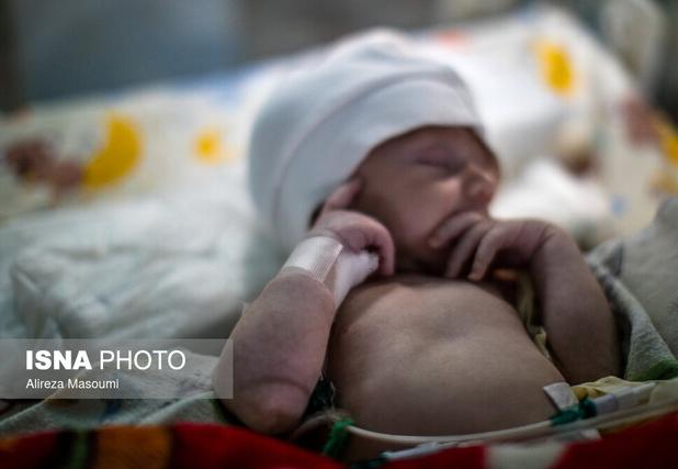 ناهنجاری‌های بدو تولد اولین عامل مرگ کودکان زیر 5 سال