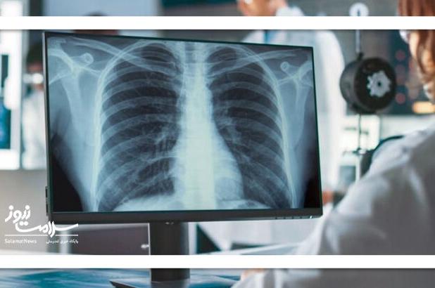 هوش مصنوعی از روی عکس رادیولوژی پوکی استخوان را تشخیص میدهد