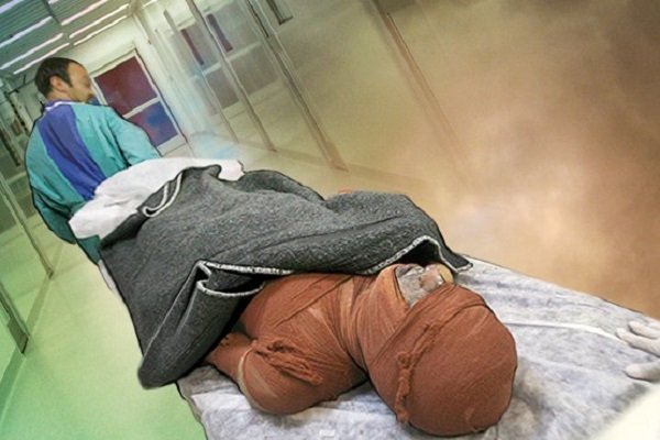 اقدامات ضروری در مواجهه با فرد دچار جراحت انفجاری